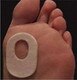 Aetna C-5 Corn Pedi-Pads Foam 1/4" Adhesive -100- 610-05309
