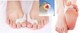 CMS Medical Silica Gel Triple Action Toe Spacer Bunion Guard Combo